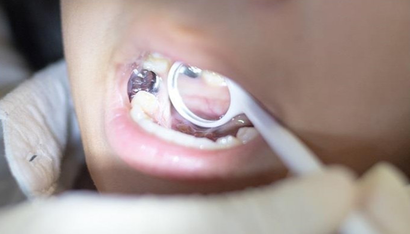 Odontoiatria conservativa